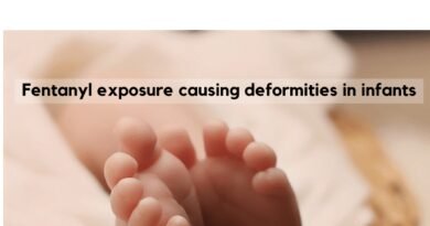 Fentanyl exposure symptoms