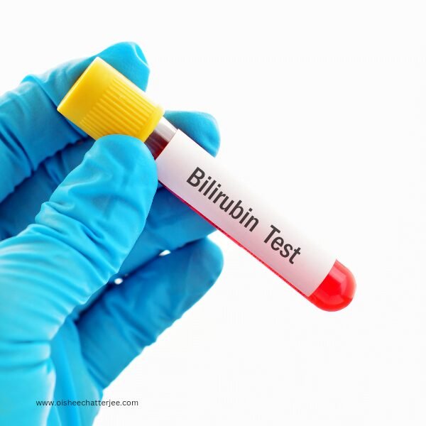 Bilirubin test sample