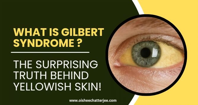 What is Gilbert Syndrome -topic of the blog described with image