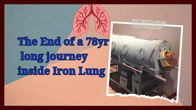 The image of iron lung describing the topic of blog