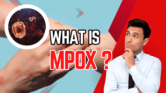 The image shows the topic of the blog is about Mpox